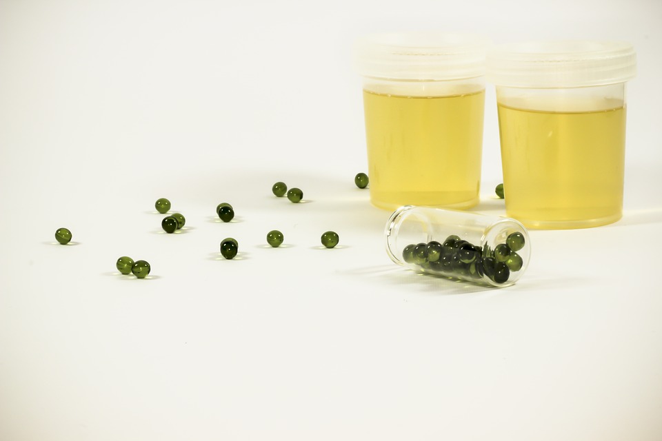 urinalysis