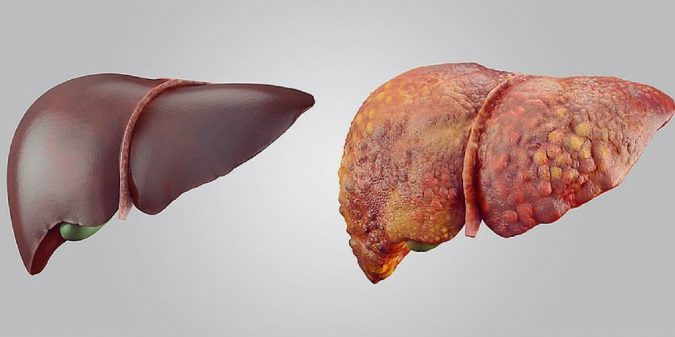 lfts liver function tests