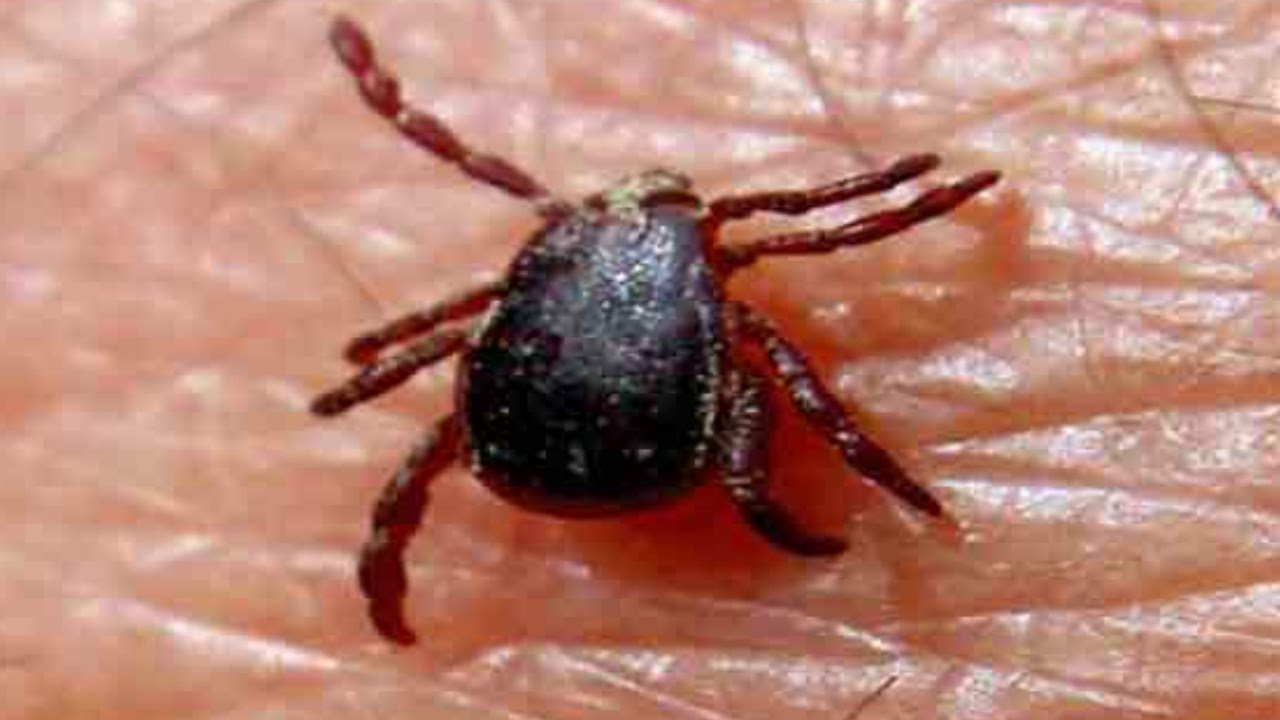 tick bite