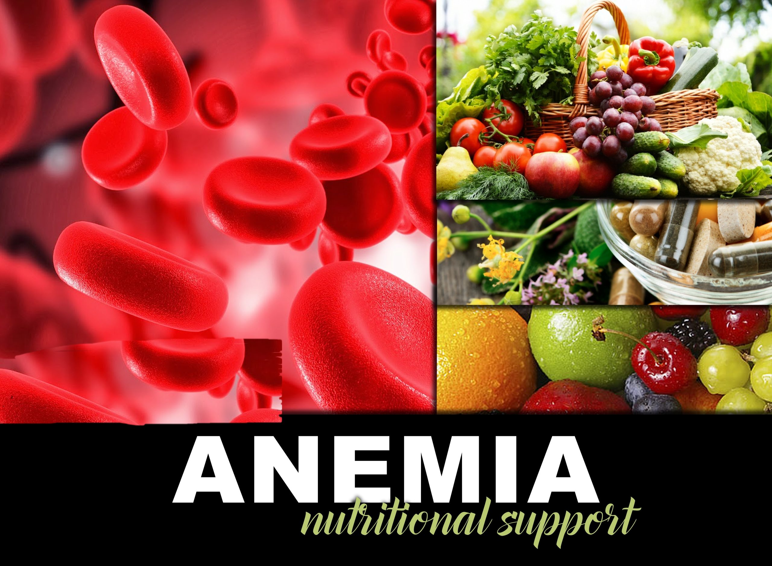 nutritional anemia